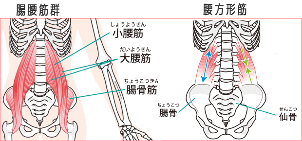 ぎっくり腰画像2